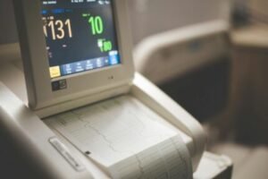 how to choose best ecg devices