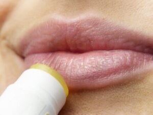 Home Remedies for cracked lip corners